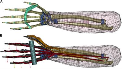 An investigation of tendon strains in jersey finger injury load cases using a finite element neuromuscular human body model